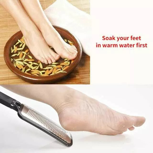 Foot File and Callus Remover. Best Foot Care Pedicure High Grade Stainless Steel File